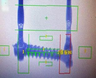 保險(xiǎn)絲焊接缺陷檢測(cè)